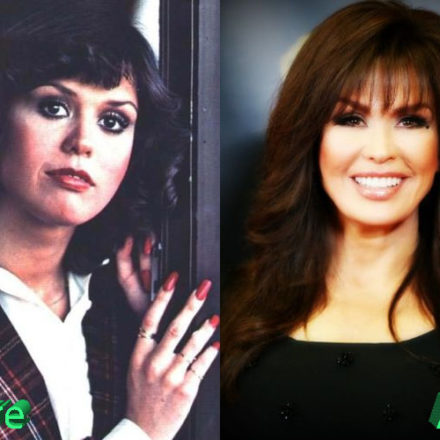 Marie Osmond Plastic Surgery Marie S Youthful Looks