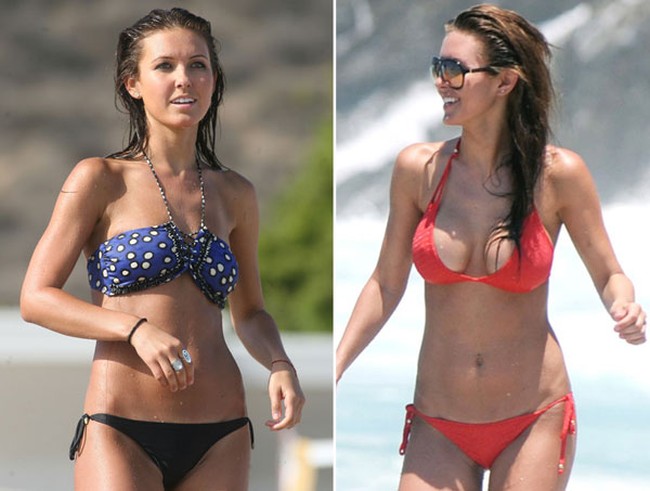 Audrina before and after