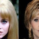 Jane Fonda before and after plastic surgery