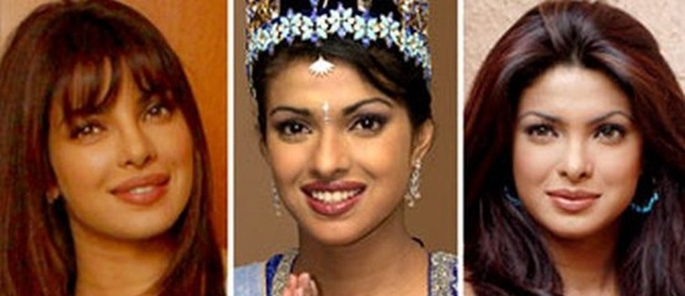Priyanka Chopra before and after nose job plastic surgery