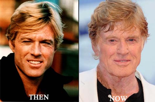 Robert Redford before after plastic surgery