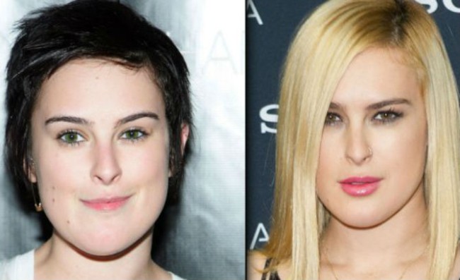 Rumer Willis before and after plastic surgery