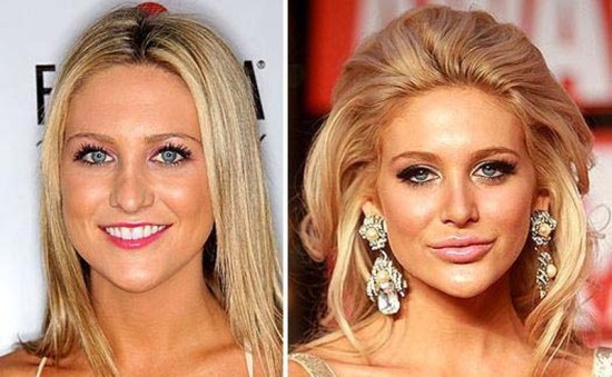 Stephanie Pratt before and after pictures