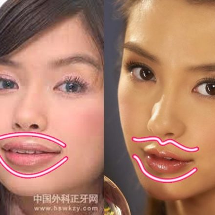 The miraculous transformation of the Angelababy plastic surgery