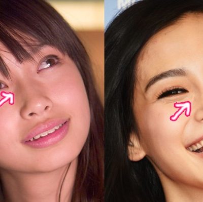 The miraculous transformation of the Angelababy plastic surgery