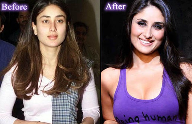 Kareena Kapoor before and after breast implants