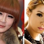 Park Bom before and after plastic surgery