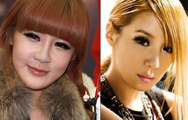 Park Bom before and after plastic surgery