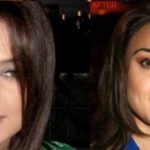 Preity Zinta before and after nose job plastic surgery