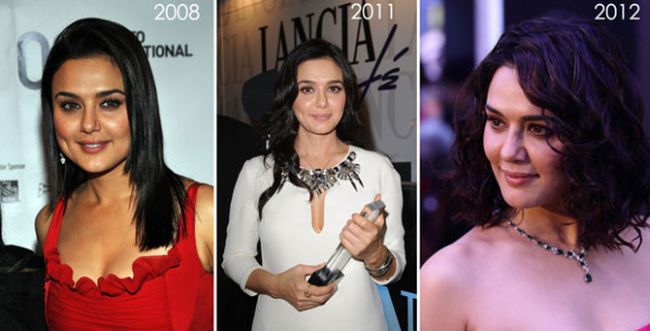 Preity Zinta before and after plastic surgery