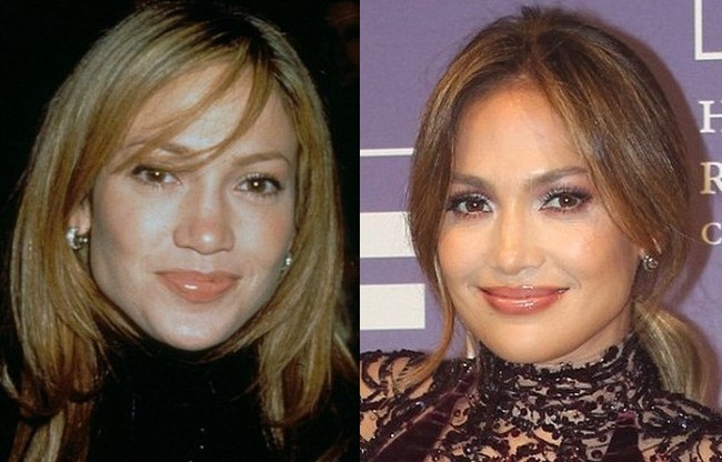 Jennifer Lopez Plastic Surgery Rumors Abound