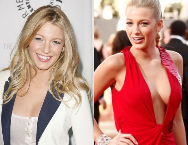 Blake Lively before and after breast implants.