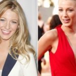 Blake Lively before and after breast augmentation