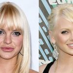 anna faris plastic surgery pictures