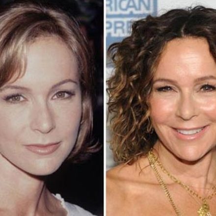 Jennifer Grey Plastic Surgery Mishap