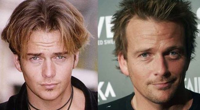 Sean Patrick Flanery Plastic Surgery Before and After.
