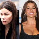 Sofia Vergara Before And After Plastic Surgery