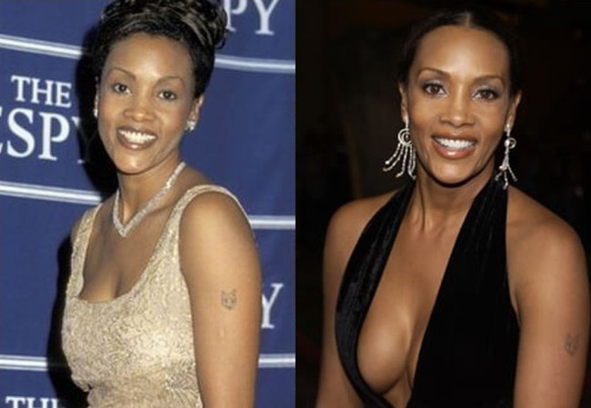 Vivica Fox Before And After Plastic Surgery