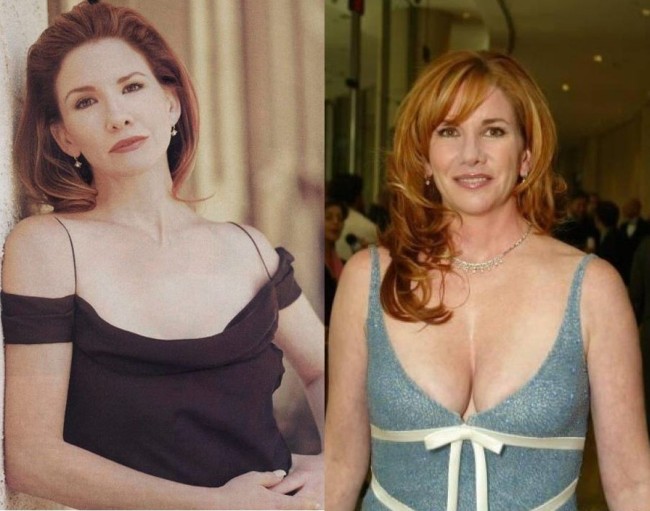 Melissa Gilbert Plastic Surgery Before And After Breast Augmentation