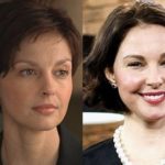 Ashley Judd Before And After Botox Injections