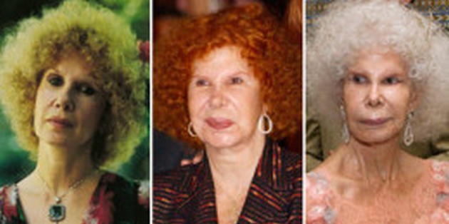 Duchess of Alba before and after surgery photos