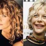 Hollywood Celebrity Meg Ryan before and after surgery photos