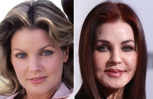 Priscilla Presley Before And After Plastic Surgery