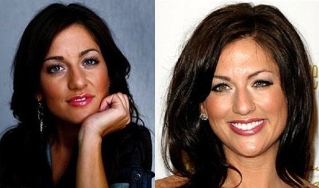 Jillian Harris Before And After Nose Job Plastic Surgery