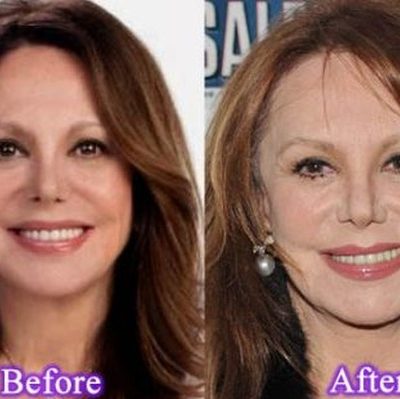 After Insignificant Nose Job Marlo Thomas Got Carried Away