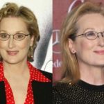 Meryl Streep Before And After Botox Injections