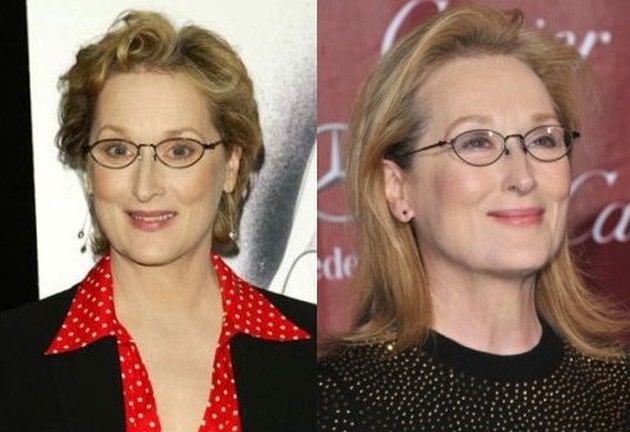 Meryl Streep Before And After Botox Injections