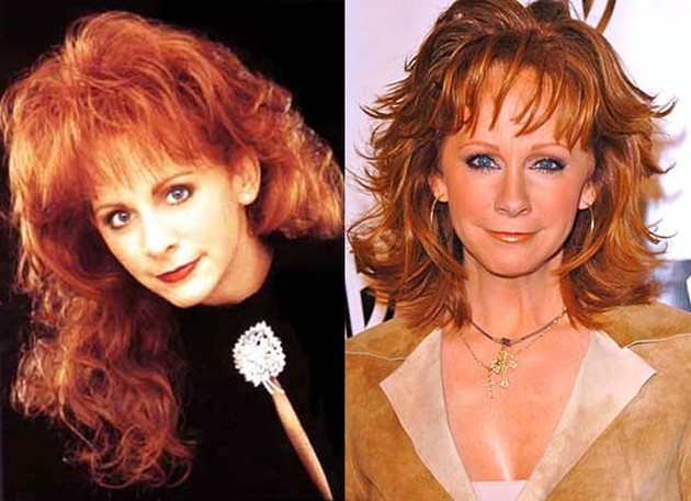Reba McEntire Looks Great After Plastic Surgery