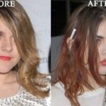 After Lip Filling Job Frances Bean Cobain’s Lips Look Glossy And Filled