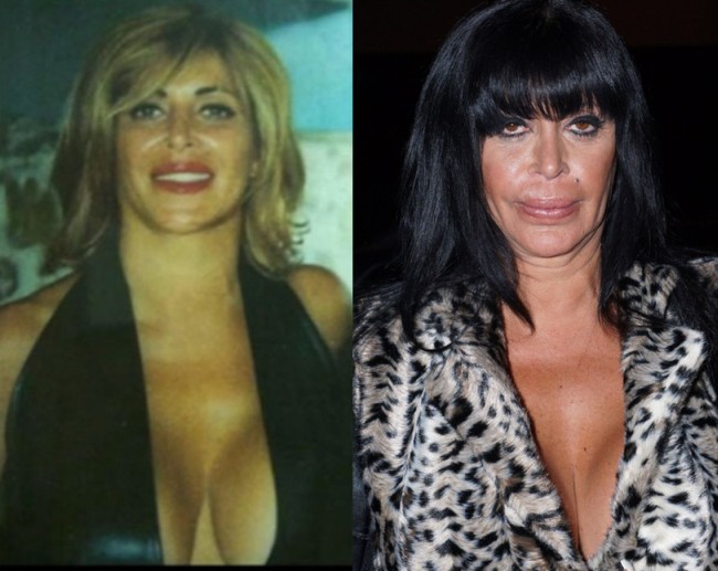 Big Ang Before and After Pictures