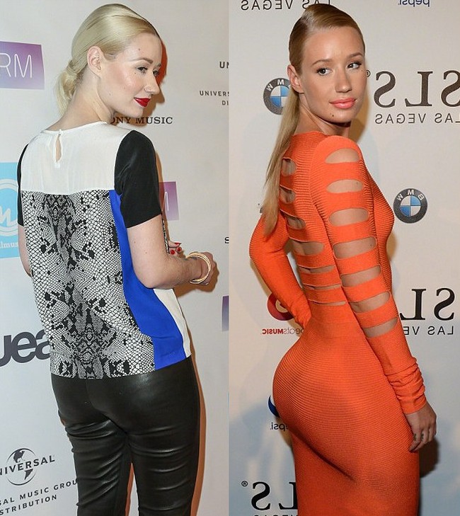 Iggy Azalea Before And After Alleged Butt Implants