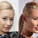 Iggy Azalea before and after nose job plastic surgery