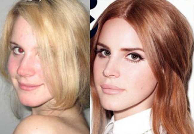 Lana-Del-Rey-before-and-after-plastic-surgery.jpg