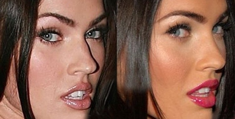 Whats The Truth About Megan Fox Plastic Surgery Claims 1319