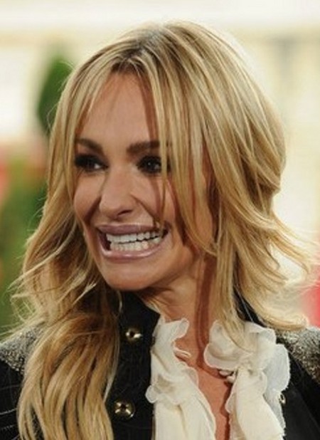 Taylor Armstrong plastic surgery gone wrong