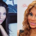 Has Tamar Braxton had any plastic surgery