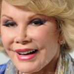 Joan Rivers Eyelid Surgery