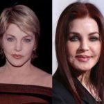 Priscilla Presley Before And After Plastic Surgery