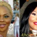 Lil Kim Before and After Plastic Surgery