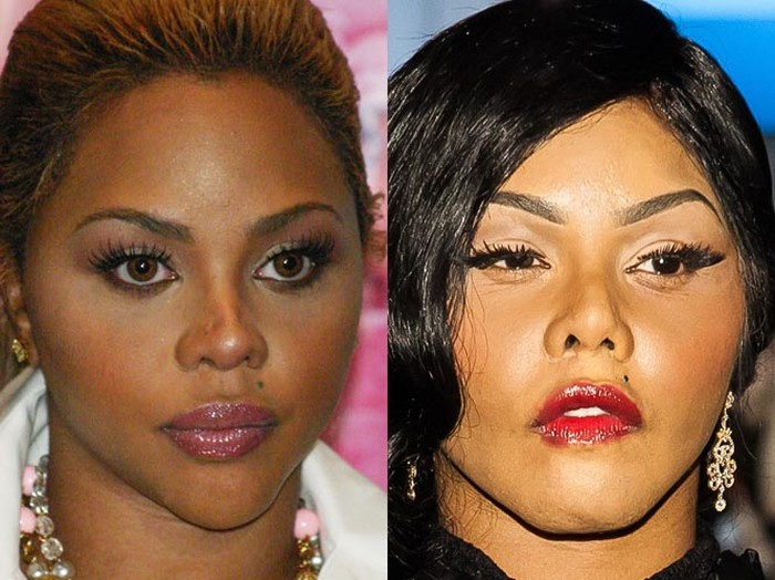 Lil Kim Plastic Surgery Transformation