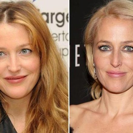 Gillian Anderson Plastic Surgery Rumors and Facts