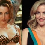 Gillian Anderson before and after plastic surgery