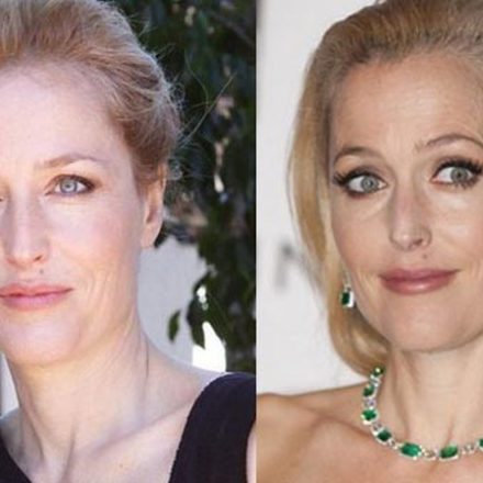 Gillian Anderson Plastic Surgery Rumors and Facts