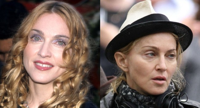Madonna disaster plastic surgery