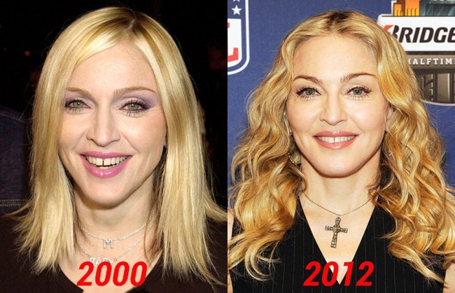 Madonna stay young thanks to plastic surgery