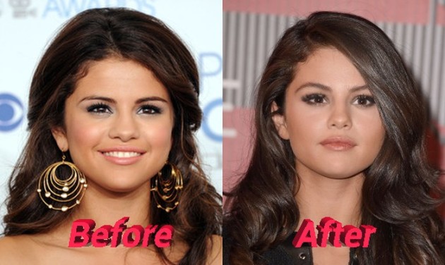 Selena Gomez Plastic Surgery Or Special Make Up? Really?